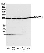 ZCWCC1 Polyclonal Antibody