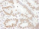 Phospho-Rad17 (Ser645) Antibody in Immunohistochemistry (Paraffin) (IHC (P))