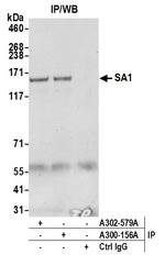 SA1 Antibody in Immunoprecipitation (IP)