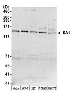 SA1 Antibody in Western Blot (WB)