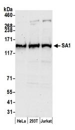 SA1 Antibody in Western Blot (WB)