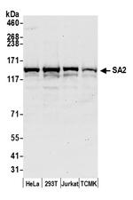 SA2 Antibody in Western Blot (WB)