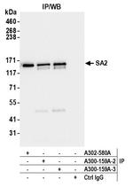 SA2 Antibody in Immunoprecipitation (IP)