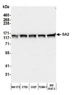 SA2 Antibody in Western Blot (WB)