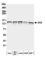 SA2 Antibody in Western Blot (WB)
