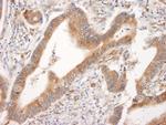 BID Polyclonal Antibody