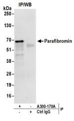 Parafibromin Antibody in Immunoprecipitation (IP)