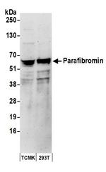 Parafibromin Polyclonal Antibody
