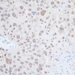 Leo1 Polyclonal Antibody