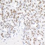 PELP1/MNAR Antibody in Immunohistochemistry (Paraffin) (IHC (P))