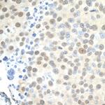 PELP1/MNAR Antibody in Immunohistochemistry (Paraffin) (IHC (P))