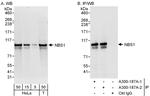 NBS1 Antibody in Western Blot (WB)
