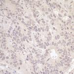 RFC3 Polyclonal Antibody