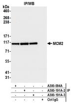 MCM2 Antibody in Immunoprecipitation (IP)