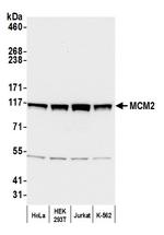 MCM2 Antibody in Western Blot (WB)