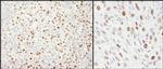 MCM4 Polyclonal Antibody