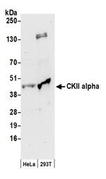 CKII alpha Polyclonal Antibody