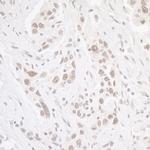 CKII alpha Polyclonal Antibody