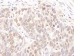 CKII alpha Polyclonal Antibody