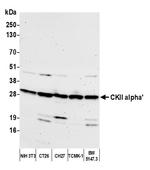 CKII alpha' Polyclonal Antibody