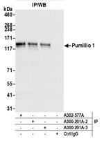 Pumilio 1 Antibody in Immunoprecipitation (IP)