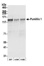 Pumilio 1 Polyclonal Antibody