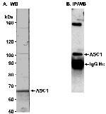 TRIP4/ASC-1 Antibody in Western Blot (WB)
