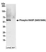 Phospho-WASP (Ser483, Ser484) Polyclonal Antibody