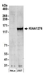 KIAA1276 Polyclonal Antibody