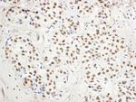 BHC110/LSD1 Polyclonal Antibody