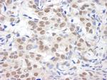 BHC110/LSD1 Polyclonal Antibody