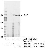 Cul7 Polyclonal Antibody