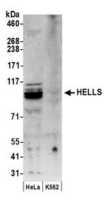 HELLS Polyclonal Antibody