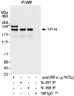 KIF14 Polyclonal Antibody