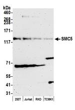 SMC5 Polyclonal Antibody