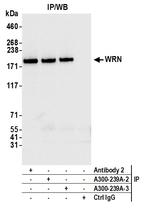 WRN Antibody in Immunoprecipitation (IP)