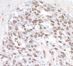 ZHX1 Polyclonal Antibody