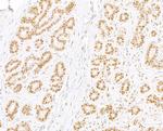 RPA32 Polyclonal Antibody