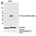 Phospho-RPA32 (Ser4, Ser8) Antibody in Immunoprecipitation (IP)