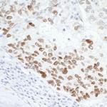 p53 Antibody in Immunohistochemistry (Paraffin) (IHC (P))