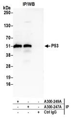 p53 Antibody in Immunoprecipitation (IP)