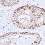 p53 Antibody in Immunohistochemistry (Paraffin) (IHC (P))