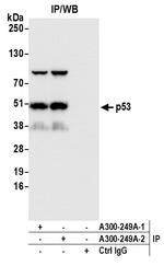 p53 Antibody in Immunoprecipitation (IP)