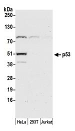 p53 Antibody in Western Blot (WB)