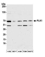 PLK1 Polyclonal Antibody