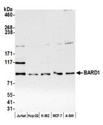 BARD1 Antibody in Western Blot (WB)