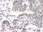 ZNF261 Polyclonal Antibody