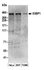 53BP1 Antibody in Western Blot (WB)