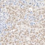 KAP-1 Antibody in Immunohistochemistry (Paraffin) (IHC (P))