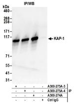 KAP-1 Antibody in Immunoprecipitation (IP)